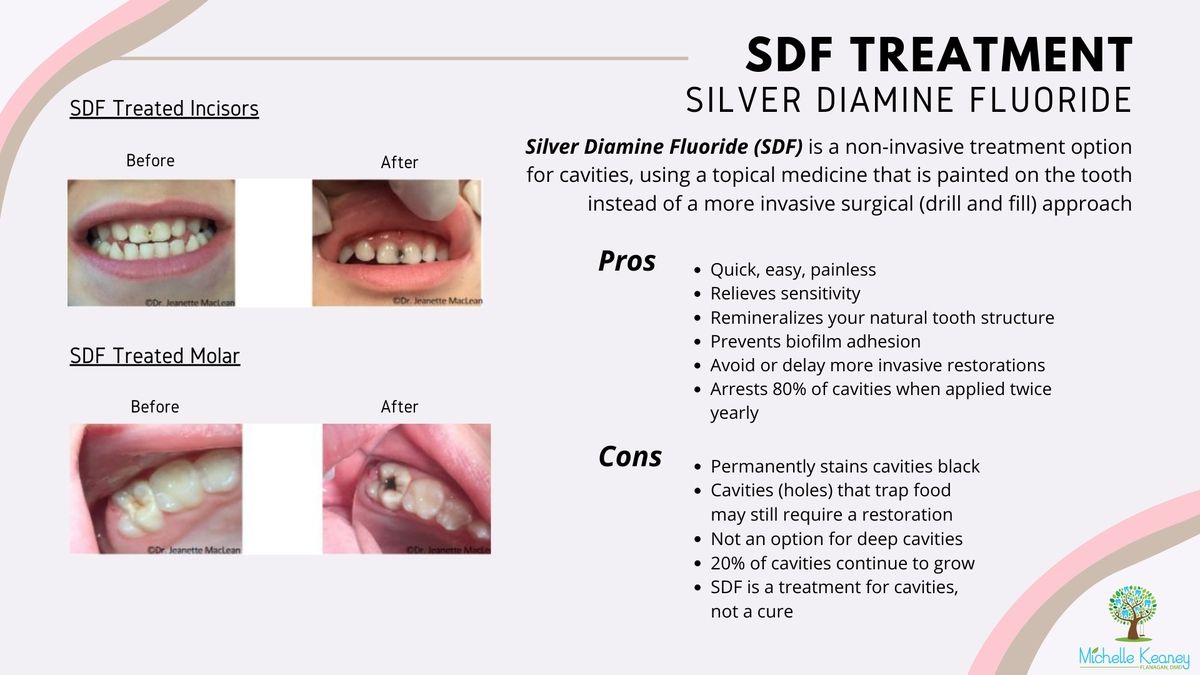 Unlocking the Power of Fluoride