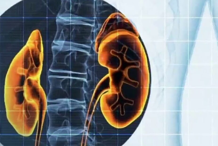 How Did Race Impact Kidney Function Calculations? A Biased Test Delays Transplants for Black Patients