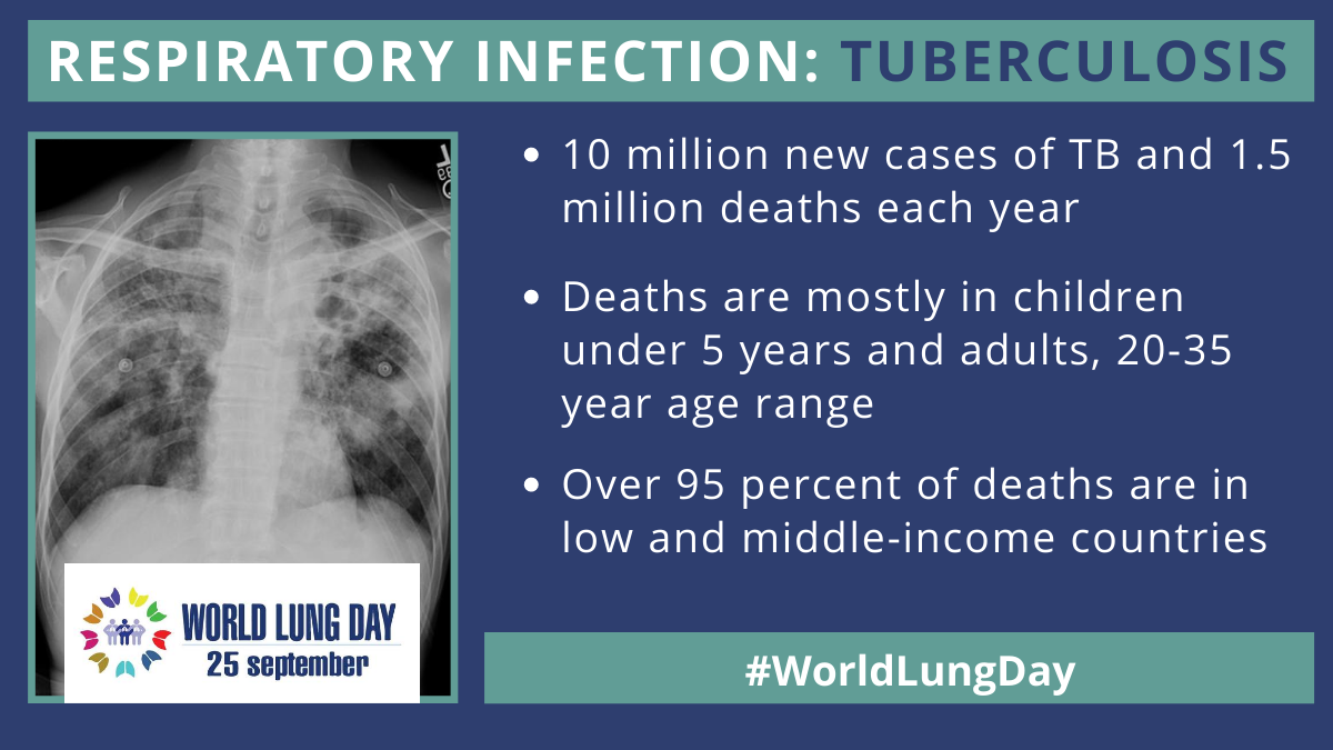 Impact of Tuberculosis on Lung Health Post-Treatment