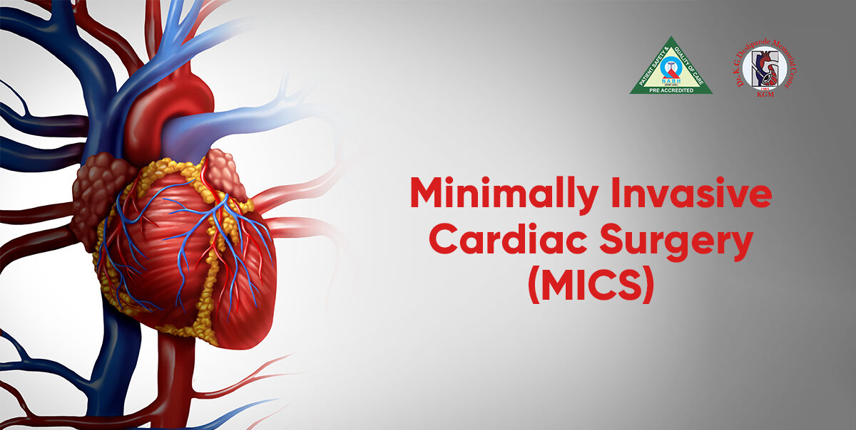 What Is the Less Invasive Approach to Heart Bypass Surgery Offering Comparable Safety and Efficacy to Traditional Methods?