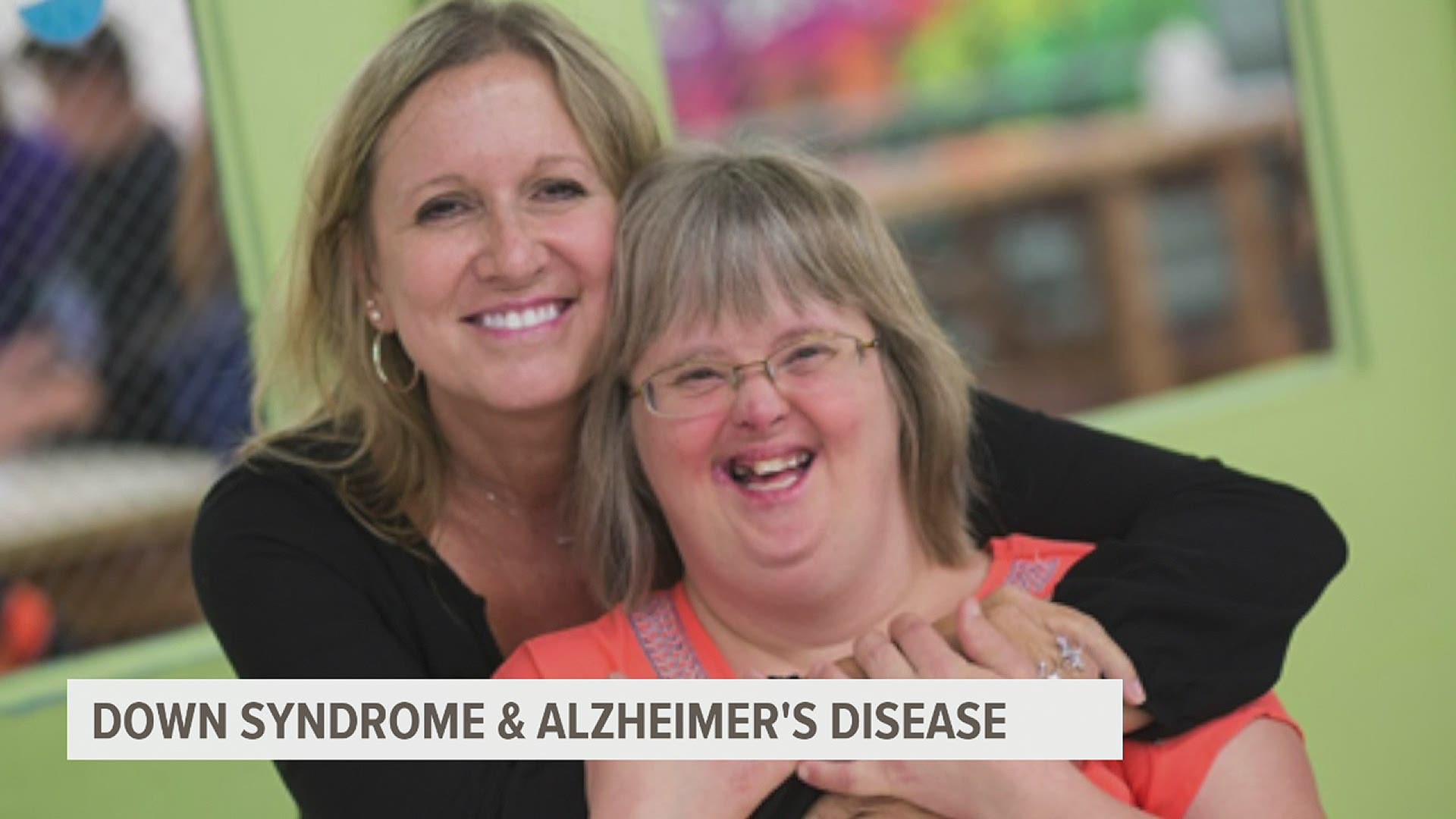 What is the impact of Down syndrome on the progression of Alzheimer's disease?