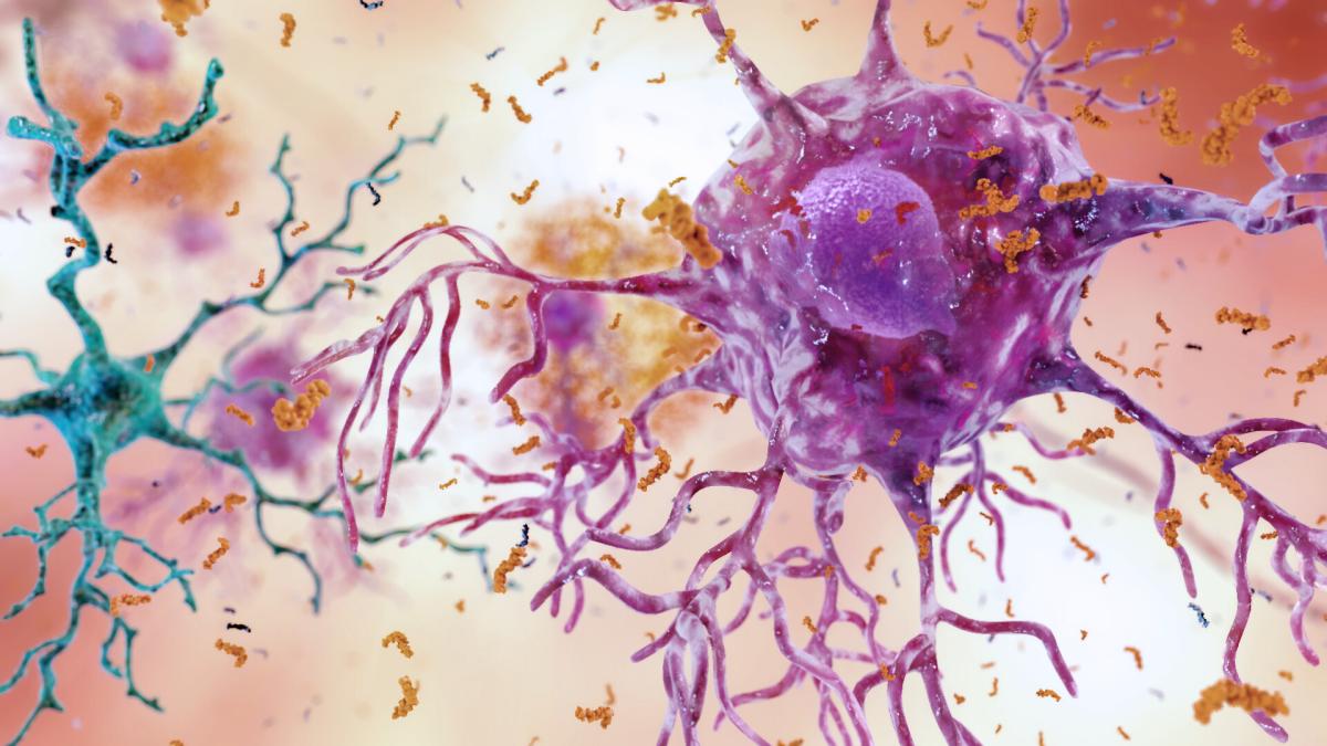 How does the aging process of certain brain cells differ based on sex and what implications does this have on Alzheimer's disease?