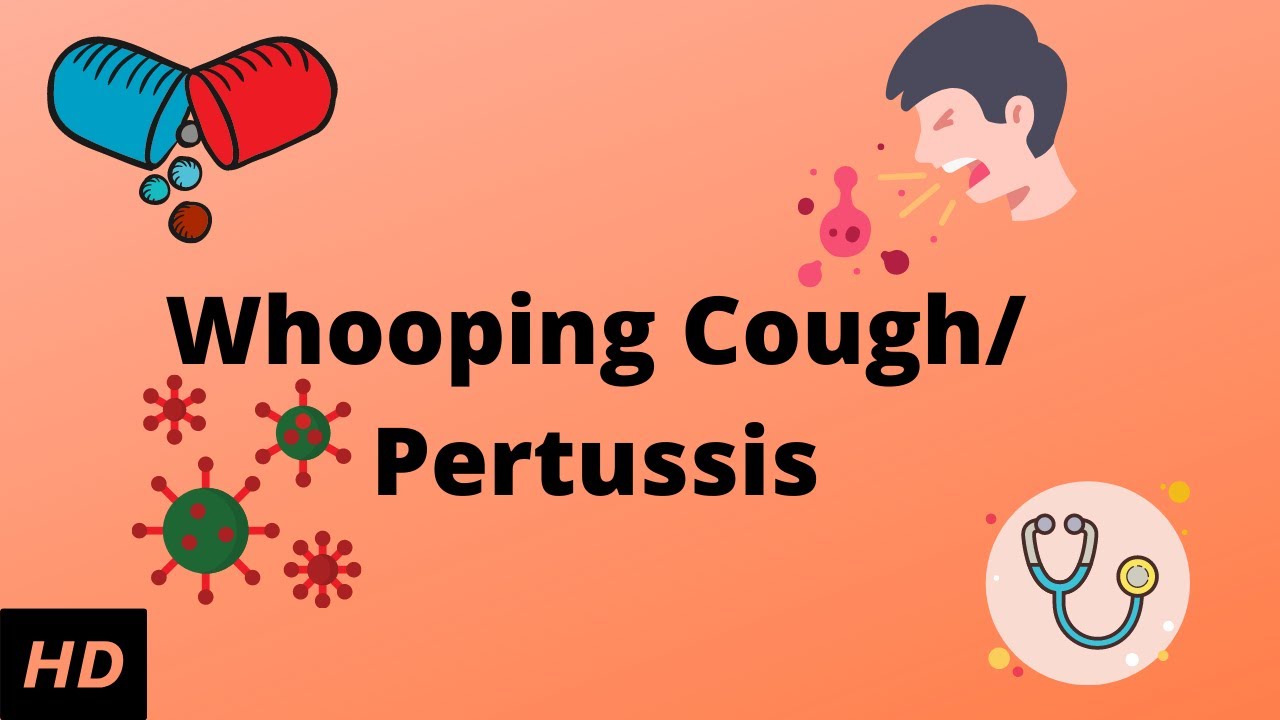 What Are the Symptoms of Whooping Cough in Infants and Adults and How Is It Treated?