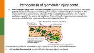 What Biomarker Could Help Predict Disease Activity in Patients with Nephrotic Syndrome?