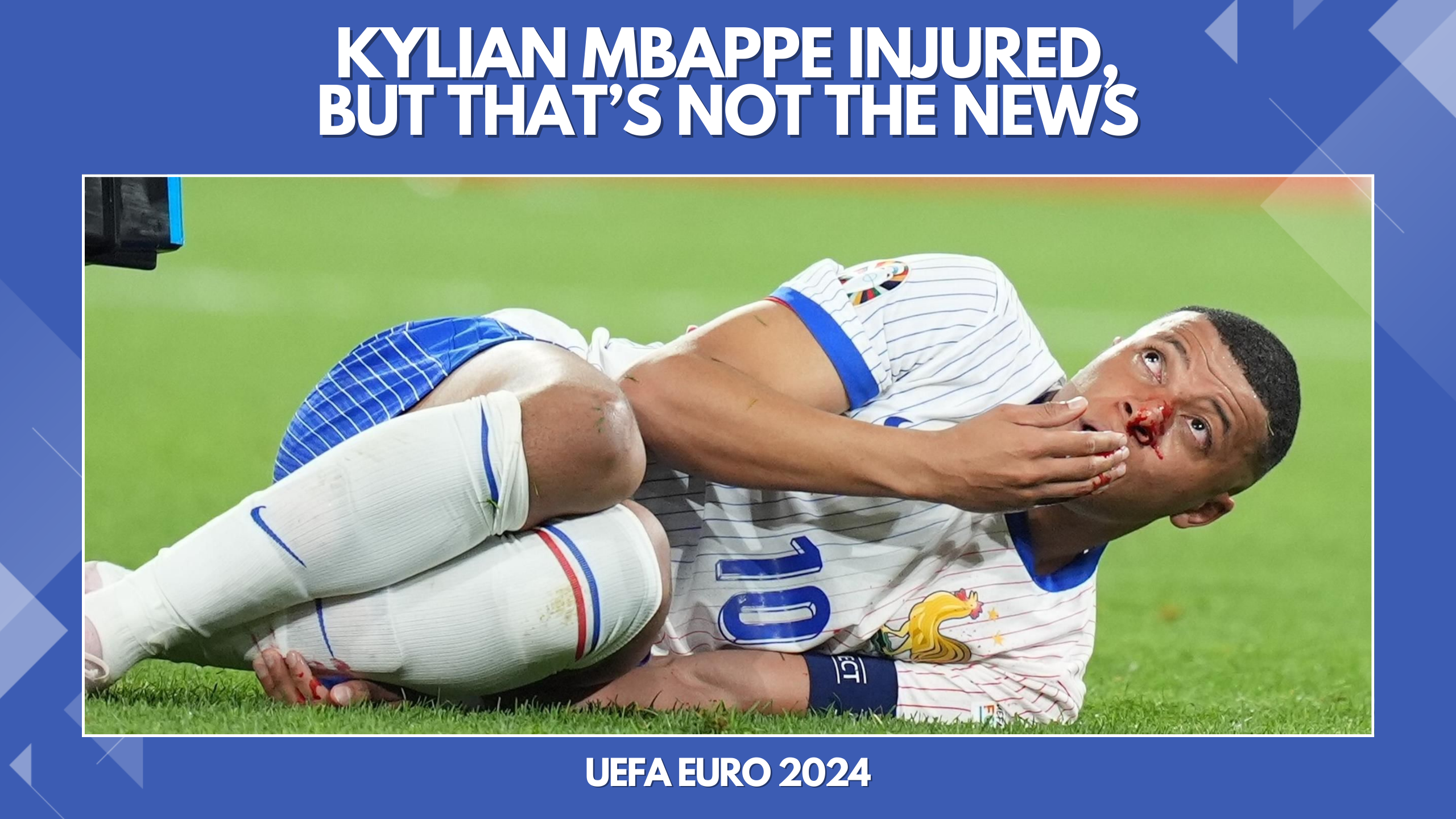 How is Kylian Mbappé coping with his injury after returning to play for France in Euro 2024?